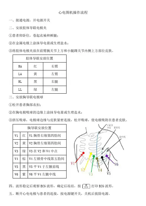 心电图操作流程