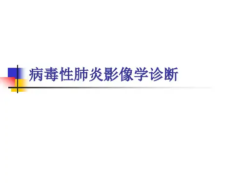病毒性肺炎影像诊断 新ppt课件