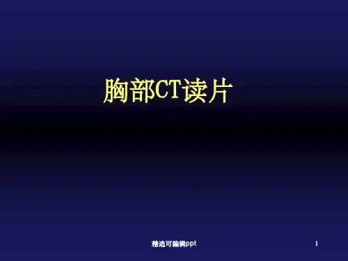胸部CT读片24631