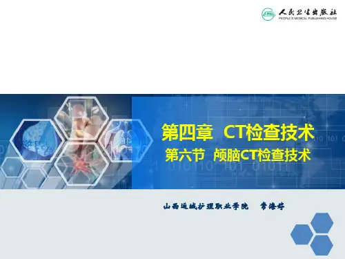 颅脑CT检查技术