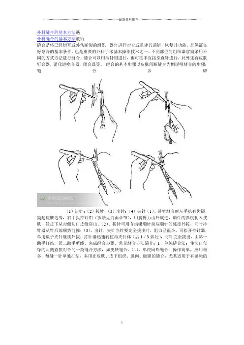 外科缝合的基本方法遇(带图)精编版