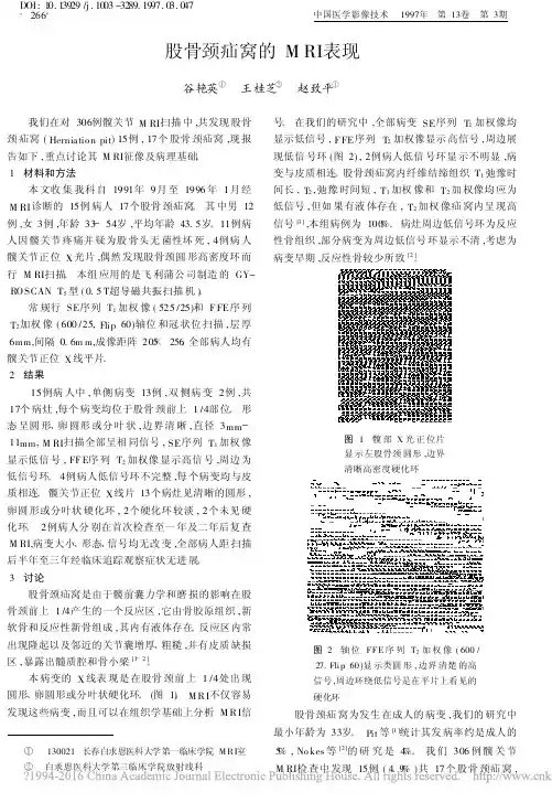 股骨颈疝窝的MRI表现