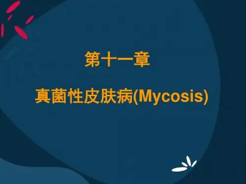 真菌性皮肤病(Mycosis)