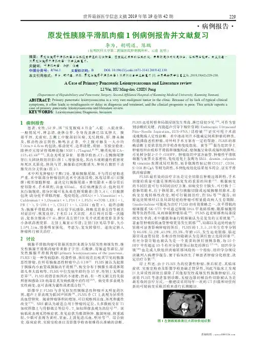 原发性胰腺平滑肌肉瘤1例病例报告并文献复习