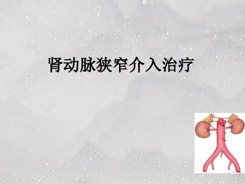 肾动脉狭窄介入治疗PPT课件