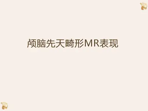 颅脑先天畸形影像诊断