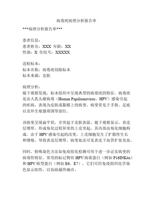 病毒疣病理分析报告单