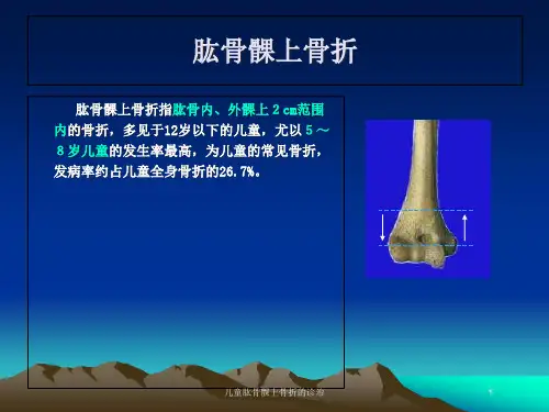 儿童肱骨髁上骨折的诊治培训课件