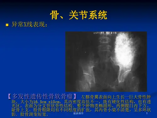 x线读片指南完整版本