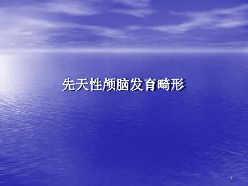 先天性脑发育畸形PPT课件