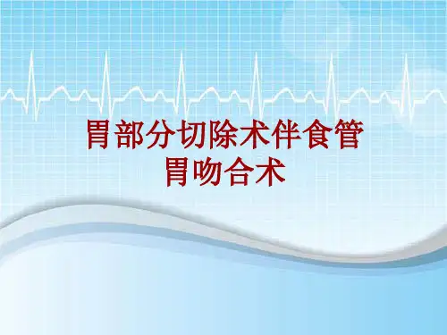 手术讲解模板：胃部分切除术伴食管胃吻合术