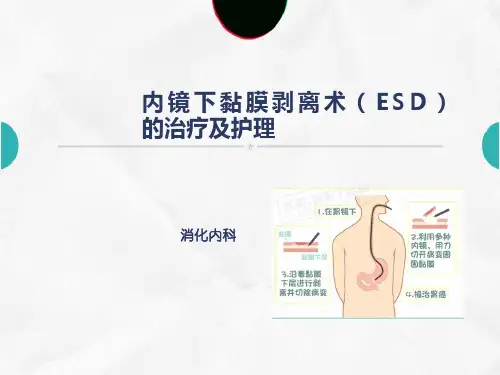 ESD患者的治疗及护理ppt课件