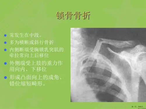 骨科常见疾病的X线表现