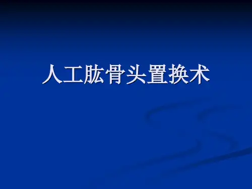 人工肱骨头置换术