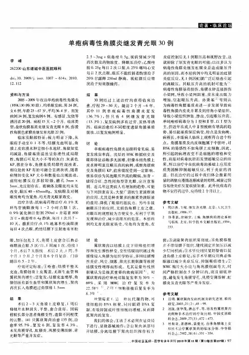 单疱病毒性角膜炎继发青光眼30例