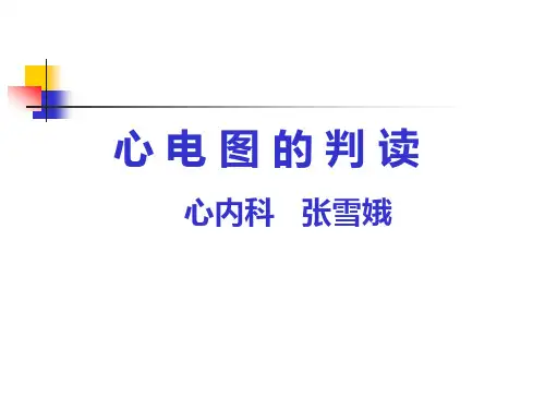 心电图判读课件PPT