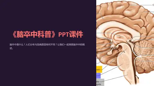 《脑卒中科普》课件