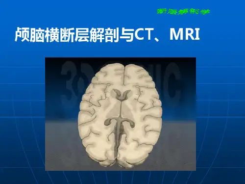 断层解剖学_头部1PPT课件