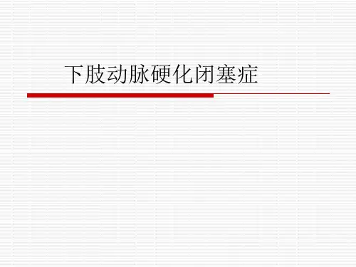下肢动脉硬化性闭塞症