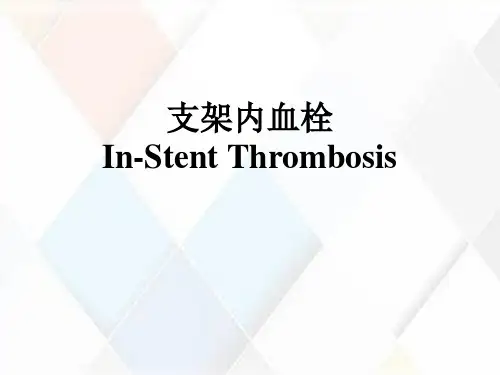 支架内血栓In-Stent Thrombosis