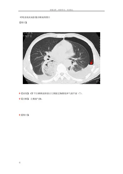 呼吸系统疾病影诊断病例图片