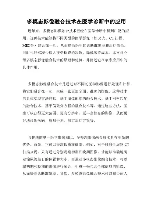 多模态影像融合技术在医学诊断中的应用