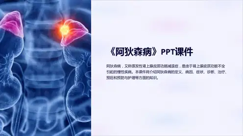 《阿狄森病》课件
