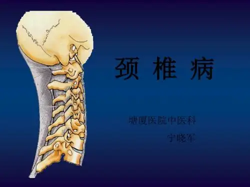 中医治疗颈椎病 PPT