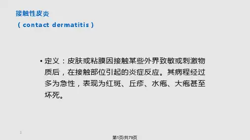 皮炎和湿疹PPT课件