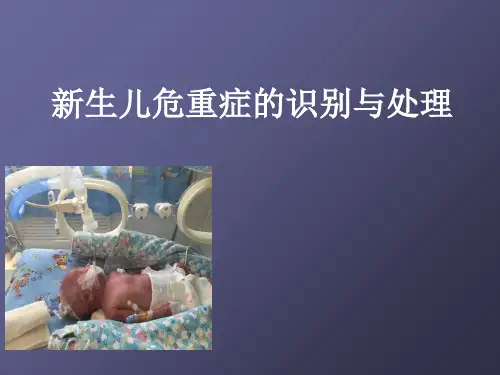 危重新生儿的处理识别与处理ppt课件