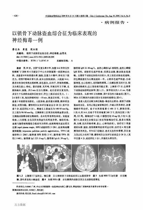 以锁骨下动脉盗血综合征为临床表现的神经梅毒一例