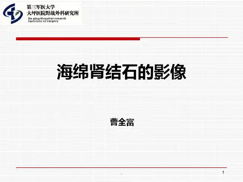 海绵肾PPT课件