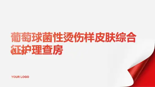 2024年葡萄球菌性烫伤样皮肤综合征护理查房PPT