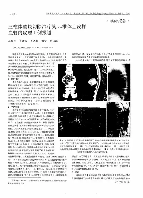 三椎体整块切除治疗胸7～9椎体上皮样血管内皮瘤1例报道