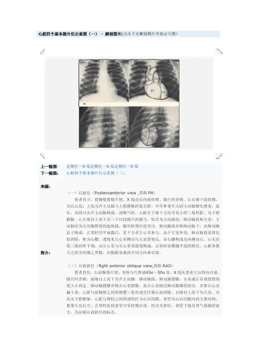 心脏四个基本摄片位示意图(一) - 解剖图片