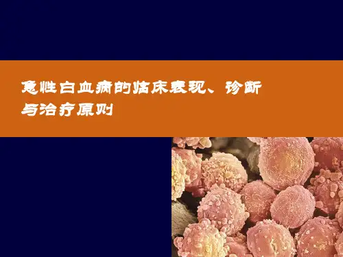 急性白血病的诊断与治疗PPT课件