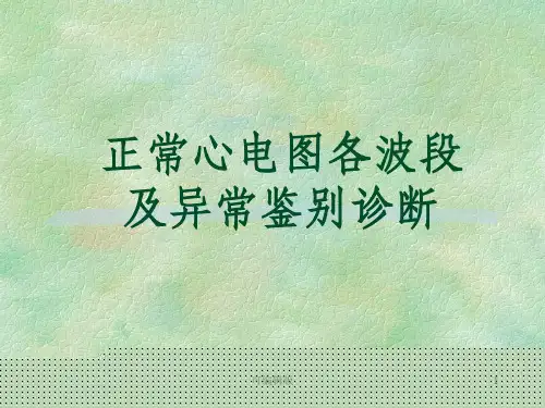 正常心电图各波段及异常鉴别诊断