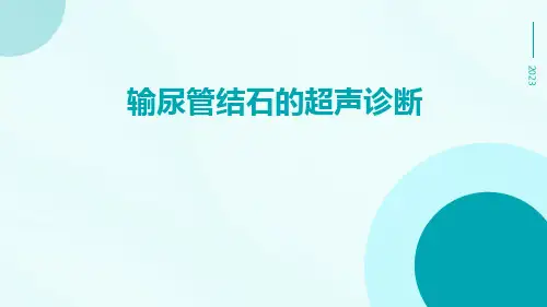(医学课件)输尿管结石的超声诊断