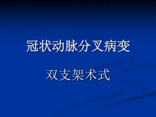 冠脉分叉病变术式