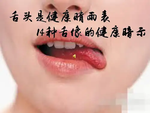 舌头是健康晴雨表14种舌像的健康暗示ppt课件