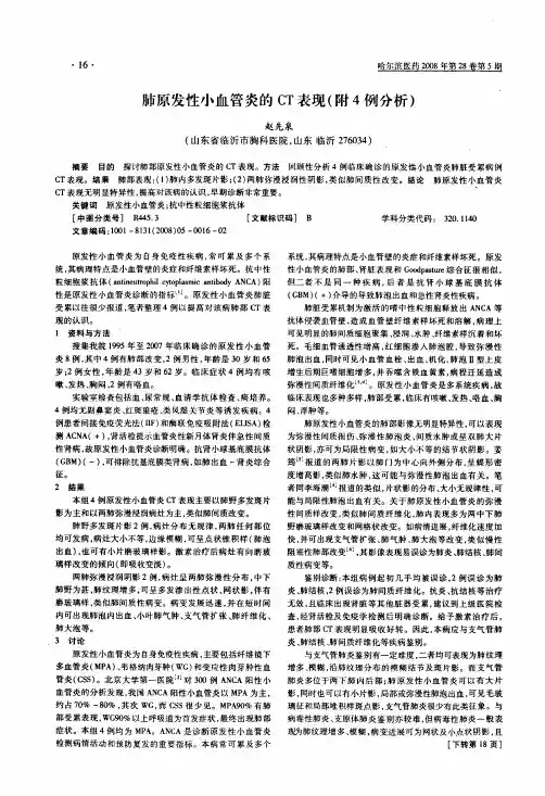 肺原发性小血管炎的CT表现附4例分析