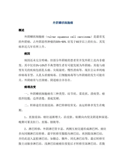 外阴鳞状细胞癌