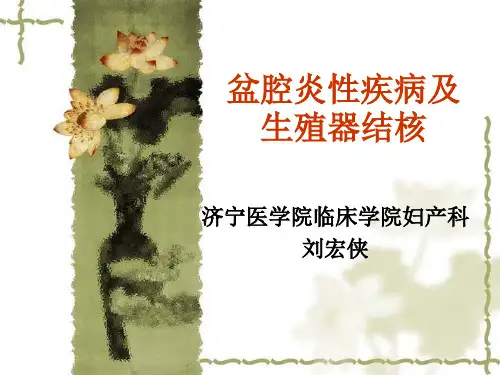 盆腔炎