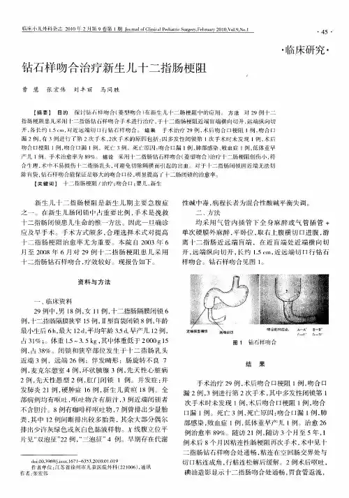 钻石样吻合治疗新生儿十二指肠梗阻