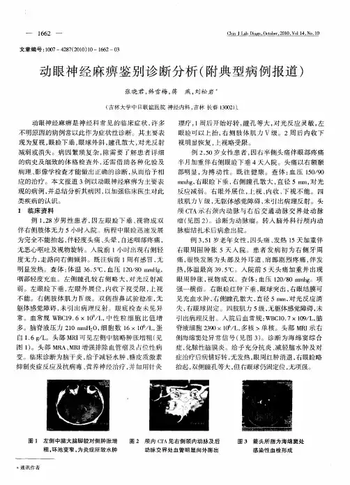 动眼神经麻痹鉴别诊断分析(附典型病例报道)