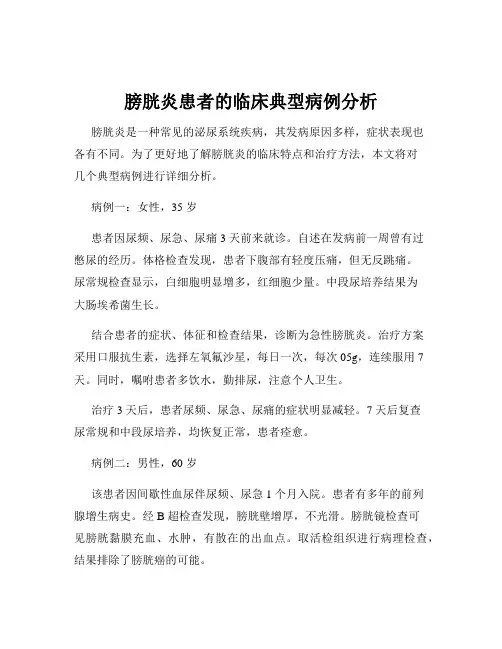 膀胱炎患者的临床典型病例分析