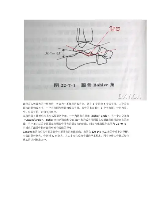 根骨结节角