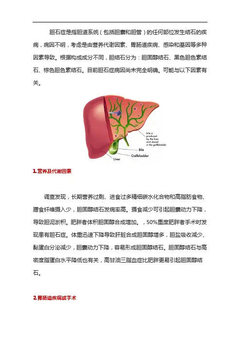 胆石症胆囊结石常见病因