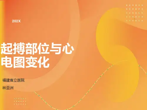 不同起搏部位心电图