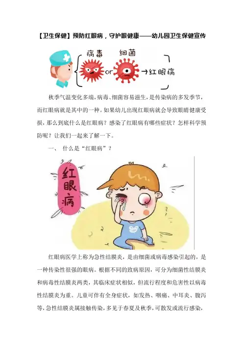 【卫生保健】预防红眼病,守护眼健康——幼儿园卫生保健宣传